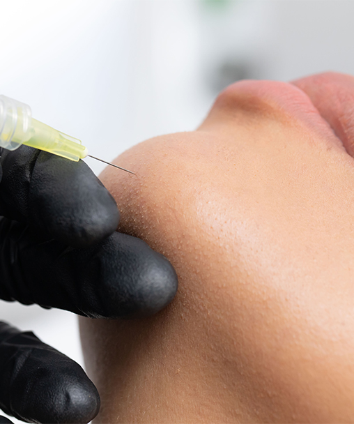 Clínica Dermoestética en Alicante | Proyección mentón