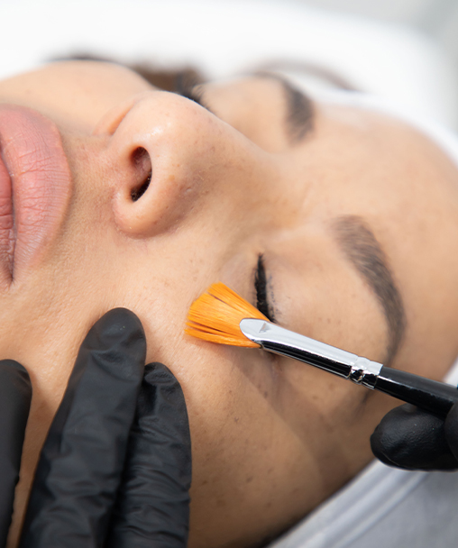 Clínica Dermoestética en Alicante | Tratamiento periocular