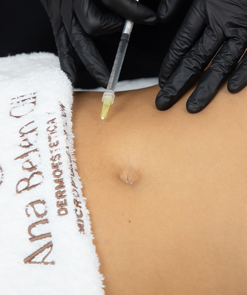 Clínica Dermoestética en Alicante | Mesoterapia corporal